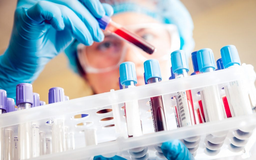 Kỹ thuật mới chẩn đoán chính xác, điều trị hiệu quả ung thư máu