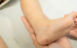 Cảnh báo nguy cơ trẻ lây bệnh tay chân miệng từ người lớn