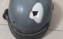 TP.HCM: Nam thanh niên bị người đàn ông tấn công 'vô cớ' trên đường phải nhập viện