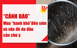 Mùa hanh khô 2025 sớm và khắc nghiệt, gàu ngứa dễ ‘tấn công’ da đầu nhạy cảm