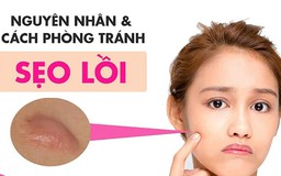 Sẹo lồi: Nguyên nhân và cách điều trị với cả sẹo lâu năm, ngừa tái phát