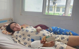 TP.HCM: Phẫu thuật thành công ca ghép bàn tay vào chân cho bệnh nhân mang song thai