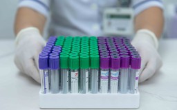 Từ 2027 quỹ BHYT sẽ chi trả sàng lọc sớm một số bệnh