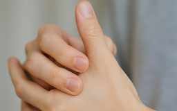 Thường xuyên bẻ khớp ngón tay có gây hại gì không?