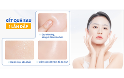 Thương hiệu Việt lên ngôi: Top 3 mặt nạ da căng mướt, bừng sáng sau 1 đêm