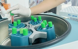 12,8% dân số trưởng thành mắc bệnh thận mạn