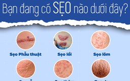 Sẹo trên mặt phải làm sao khi đã dùng đủ loại kem vẫn không cải thiện? Sẹo trên mặt phải làm sao khi đã dùng đủ loại kem vẫn không cải thiện?