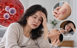 Ung thư máu: Bác sĩ lưu ý những dấu hiệu bất thường không nên bỏ qua
