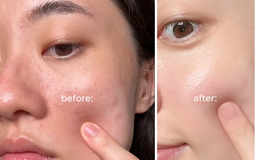 Da càng chăm càng già? Do bạn đang thiếu bước skincare retinol cho da lão hóa