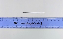 Kim may đồ nằm trong gan người đàn ông 41 tuổi