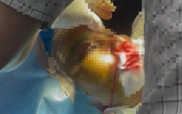 TP.HCM: Một người tử vong sau khi làm đẹp bằng phương pháp 'truyền trắng da'