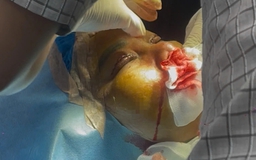 Phường Gò Vấp siết thẩm mỹ 'chui', khu CityLand là điểm 'nóng'