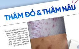 Top cách chăm sóc da thâm đỏ sau mụn bạn nên thử ngay trong routine hằng ngày