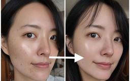 Bôi mãi kem mờ nám đắt tiền da vẫn sạm đen, thử ngay top 4 dưới đây!