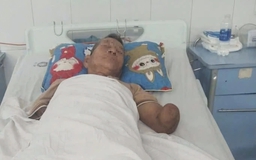 Cụ ông cụt 2 tay kẹp rắn hổ mang đem về nhà: Nhiều người tìm đến giúp đỡ