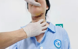 Nữ sinh ở Quảng Trị bị dây giăng ngang đường cứa vào cổ khi đi học về