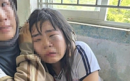 Nữ sinh lớp 7 bị nhóm nam sinh đánh hội đồng trước cổng trường