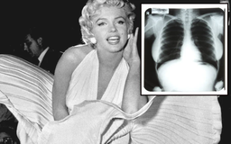 Ảnh X-quang của Marilyn Monroe gây phẫn nộ khi bị đấu giá