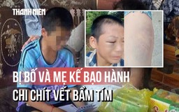 Toàn cảnh vụ bé trai nghi bị bố và mẹ kế bạo hành: Đã nhập viện với chi chít vết bầm tím