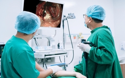 Đi ngoài phân đen nhiều ngày, người đàn ông bất ngờ phát hiện xuất huyết tiêu hóa