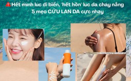 Hết mình lúc đi biển, 'hết hồn' lúc cháy nắng: 5 mẹo cứu làn da cực nhạy