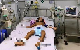 Đà Nẵng: Hai chị em ruột nguy kịch sau khi ăn chanh dây rừng còn xanh