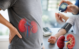 Vì sao nhiều người mất tới 80% chức năng thận mà không hề hay biết?