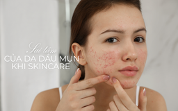 Da dầu mụn, lỗ chân lông to có cần dưỡng ẩm mùa nắng nóng đỉnh điểm không?