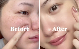 +7 kem mờ nám đậm màu 2 bên gò má đang cháy hàng, muốn mua cũng khó