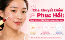 Từ che khuyết điểm đến phục hồi: Hành trình 3 giai đoạn cho da sau mụn

