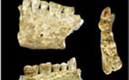 Trám răng có từ 6.500 năm trước