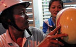 Nấm da đầu dù gội đầu thường xuyên