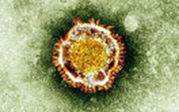 Pháp có thêm ca nhiễm virus giống SARS