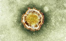 Pháp xác nhận ca nhiễm virus giống SARS đầu tiên