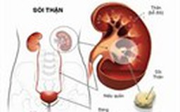 Những biến chứng của bệnh sỏi thận