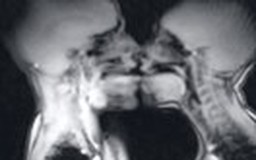 Chụp MRI lúc 'yêu'