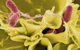 Báo động nhiễm khuẩn salmonella chưa rõ nguồn gốc tại Mỹ