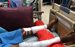 Cứu đôi chân của người đàn ông bị gãy nát do tai nạn lao động