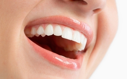 Hàm răng 'tố cáo' sức khỏe của bạn