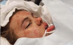 Thiếu nữ suýt chết vì thuốc lắc hạnh phúc khi bị mẹ ‘khoe’ lên Facebook