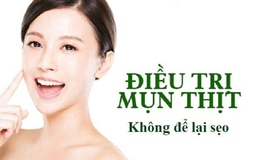 Giải pháp ngăn ngừa sẹo hiệu quả sau đốt mụn thịt