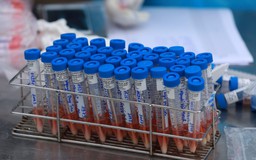 Cán bộ CDC Hà Nội bị Bộ Công an triệu tập về việc mua máy xét nghiệm Covid-19