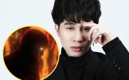 Jack tung teaser khoe lưng trần 'đốt mắt' fan