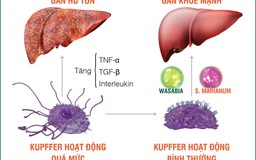 Tế bào Kupffer hoạt động quá mức gây ra nhiều bệnh lý gan
