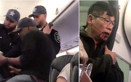 Bác sĩ gốc Việt bị đẩy khỏi máy bay, không hành lý