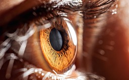 Kiểm tra mắt có thể phát hiện dấu hiệu bệnh bò điên