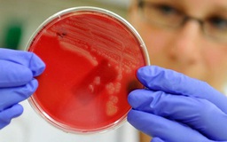 Báo động gien kháng tất cả kháng sinh xuất hiện tại Mỹ