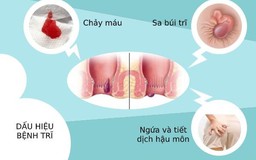 Bệnh trĩ có tự khỏi không?