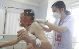 Người đàn ông ở Quảng Ninh bị lở loét vì bệnh hiếm gặp