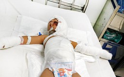 Ném 'bom xăng' kinh hoàng: Bé 3 tuổi bị bỏng, nhiễm trùng nặng